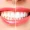 Tooth whitening